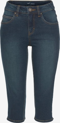 ARIZONA Skinny Jeans in Blue: front