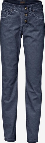 Loosefit Pantalon heine en bleu : devant