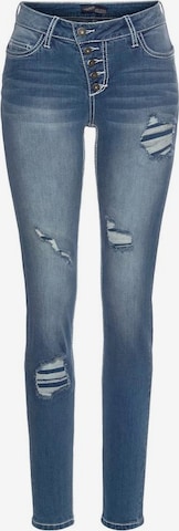 ARIZONA Skinny Jeans in Blue: front