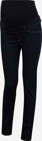 Envie de Fraise Skinny Jeans 'CLINT SEAMLES' in Blauw: voorkant