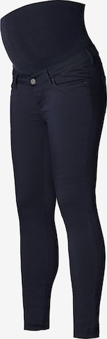 Noppies Skinny Jeans 'Romy' in Blau