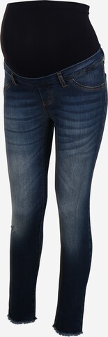Envie de Fraise regular Jeans 'DAVE' i blå: forside