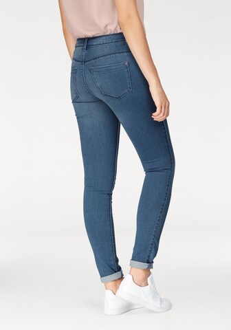 ONLY Skinny Skinny Jeans 'ONLUltimate' in Blau