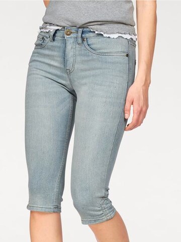 ARIZONA Skinny Jeans in Blue: front