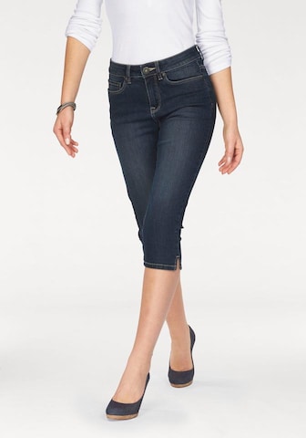 ARIZONA Skinny Jeans in Blue: front