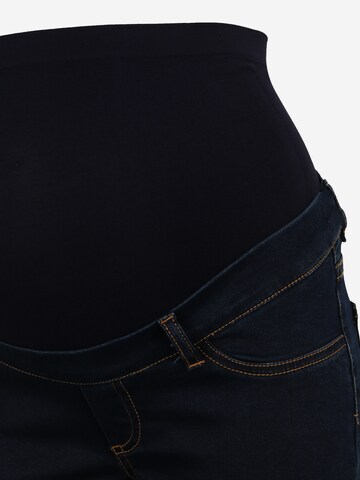 Envie de Fraise Skinny Jeans 'CLINT SEAMLES' in Blau
