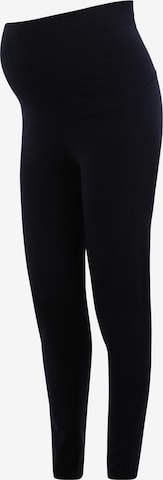 Noppies Skinny Leggings 'Rome' - kék: elől