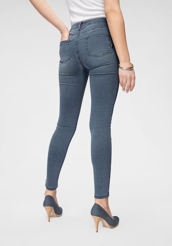 ARIZONA Skinny Jeans in Blue