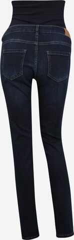 Esprit Maternity Slimfit Jeans in Blau