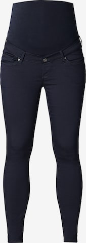 Noppies Skinny Jeans 'Romy' in Blauw: voorkant