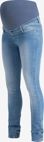 Noppies Skinny Jeans 'Avi' in Blau: predná strana