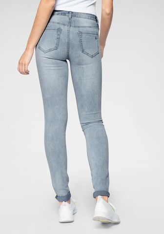Tamaris Skinny Jeans in Blau