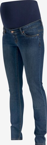 Noppies Slimfit Jeans 'Mila' in Blauw: voorkant