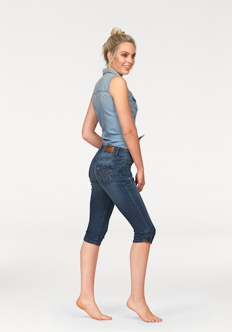 ARIZONA Skinny Jeans in Blue