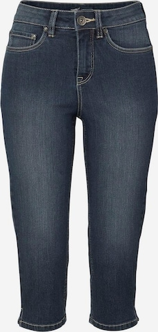 ARIZONA Skinny Jeans in Blue: front