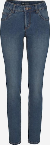 ARIZONA Skinny Jeans in Blue: front