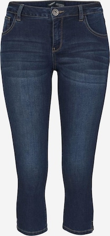 ARIZONA Skinny Jeans in Blue: front