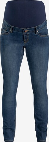 Noppies Slimfit Jeans 'Mila' in Blauw: voorkant