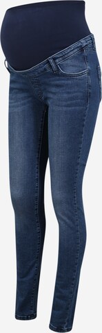 BELLYBUTTON Slimfit Jeans i blå: framsida