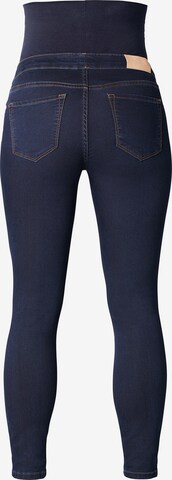 Noppies - Skinny Jeggings 'Ella' en azul