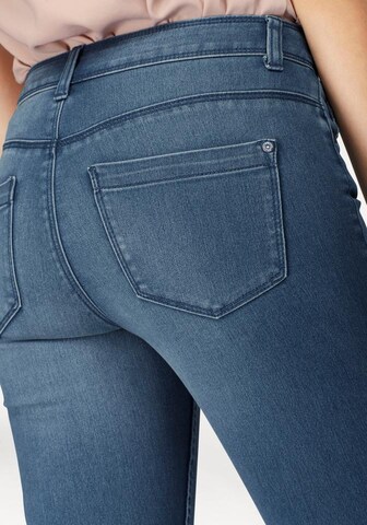 ONLY Skinny Skinny Jeans 'ONLUltimate' in Blau