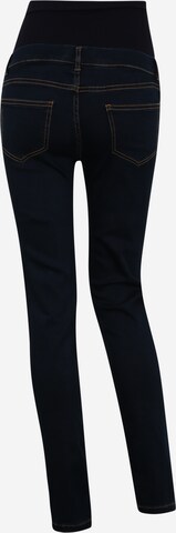 Envie de Fraise Skinny Jeans 'CLINT SEAMLES' in Blauw