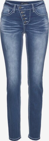 ARIZONA Jeans 'Shaping' in Blue: front