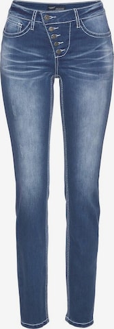 ARIZONA Skinny Jeans 'Shaping' in Blau: predná strana