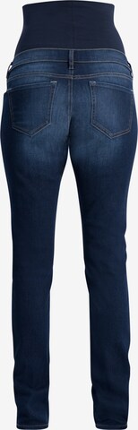 Noppies Slimfit Jeans 'Mila' in Blauw