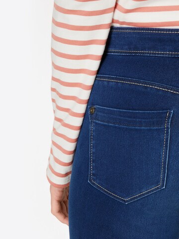 ONLY Skinny Jeans 'Ultimate' in Blauw