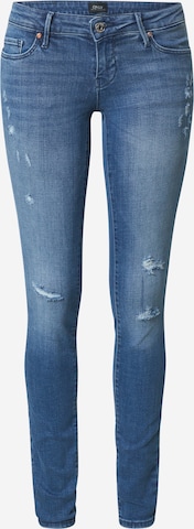 regular Jeans di ONLY in blu: frontale