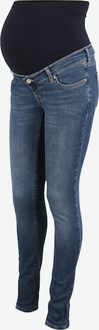 Noppies Skinny Jeans 'Avi' in Blauw: voorkant