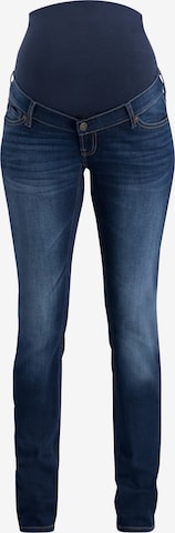 Noppies Slimfit Jeans 'Mila' in Blauw: voorkant