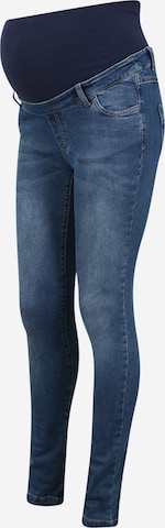 BELLYBUTTON Slimfit Jeans in Blauw: voorkant