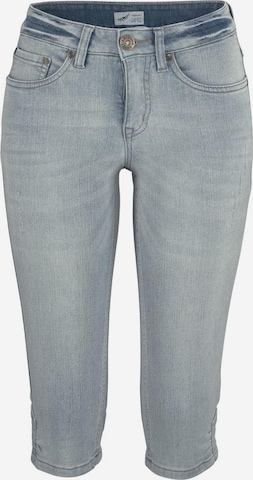 ARIZONA Skinny Jeans in Blue: front