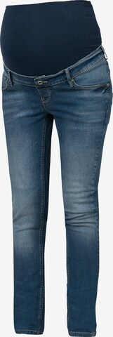 Noppies Jeans 'Tara' in Blue: front