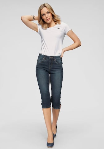 ARIZONA Skinny Jeans in Blue: front