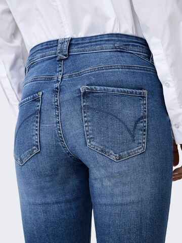 ONLY Slimfit Jeans 'ONLRush' in Blau