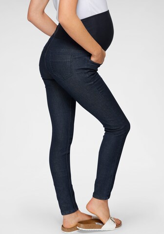 Neun Monate Skinny Jeans in Blau