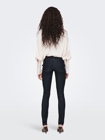 ONLY Skinny Jeans in Zwart