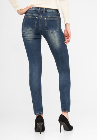 TOOche Skinny Jeans in Blau