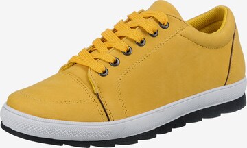 ambellis Sneakers in Yellow: front