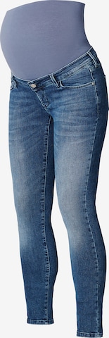 Noppies Skinny Jeans 'Avi' in Blauw: voorkant