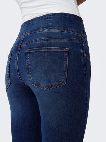 Skinny Jeans 'ONLRoyal' di ONLY in blu