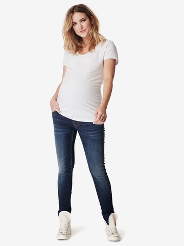 Noppies Skinny Jeans 'Avi' in Blauw