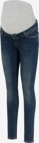 MAMALICIOUS Regular Jeans in Blue: front