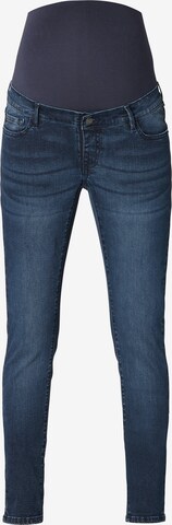 Noppies Skinny Jeans 'Avi' in Blau: predná strana
