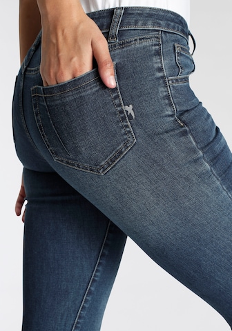 ARIZONA Skinny Jeans 'Arizona ' in Dark Blue | ABOUT YOU
