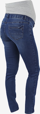 MAMALICIOUS Slimfit Jeans 'Sarnia' in Blauw