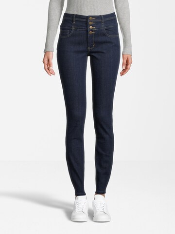 Orsay Slim fit Jeans in Blue: front